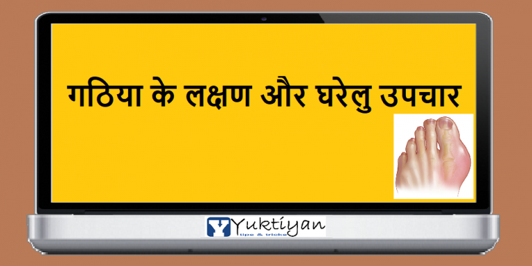 गठिया के लक्षण और घरेलु उपचार